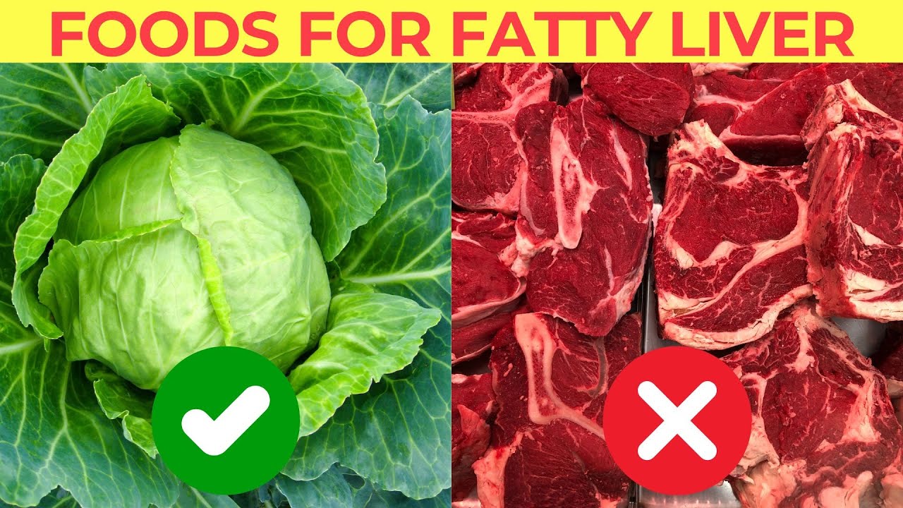 Reverse Fatty Liver l Foods Good for Fatty liver Vs Foods To Avoid in Fatty Liver #live  #fattyliver
