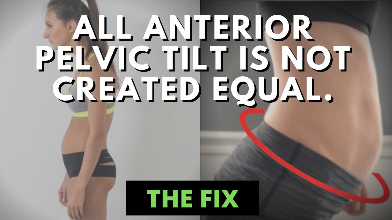 How We Compensate Into Anterior Pelvic Tilt & How to Address Individual Differences - The Fix