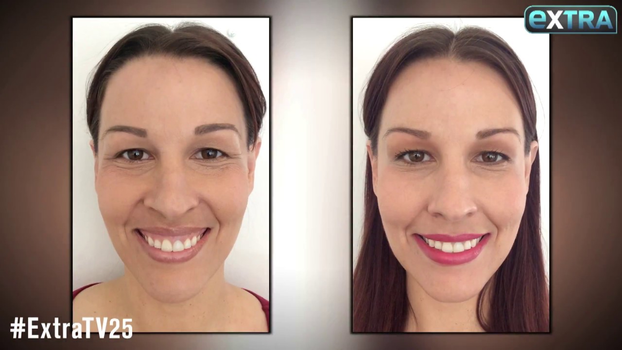 Beauty in Real Time: A Quick and Painless Way to Fix a Gummy Smile