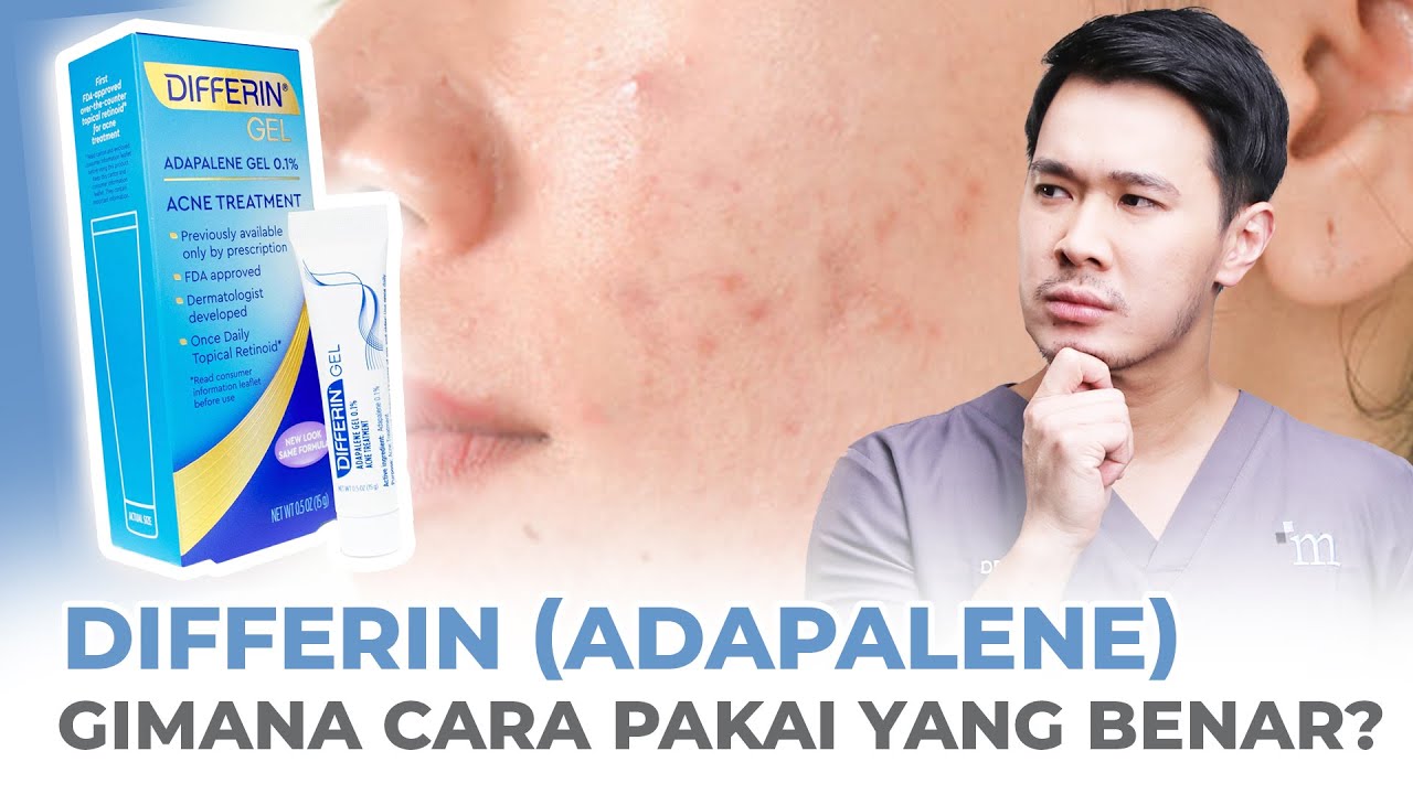 Differin (Adapalene): Gimana Cara Pakai Yang Benar?