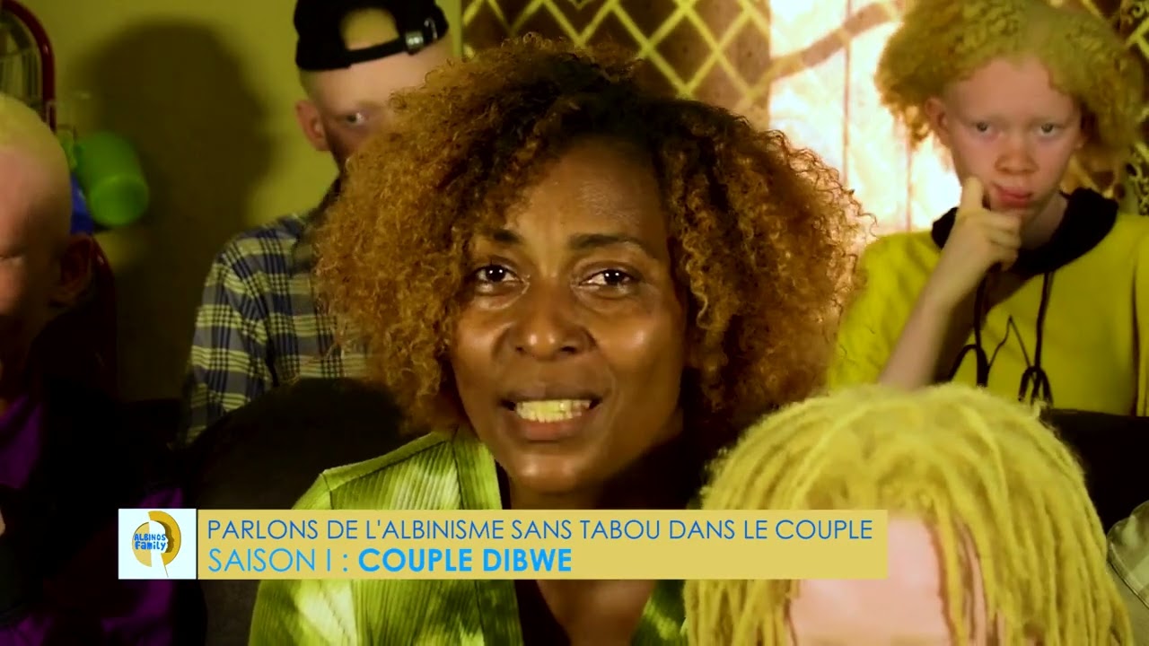 PARLONS DE L'ALBINISME SANS TABOU DANS LES COUPLES CETTE FOIS CI AVEC LE COUPLE DIBWE 
