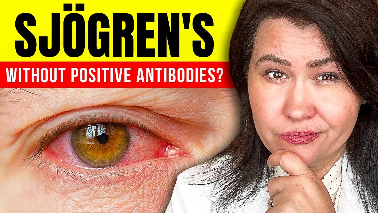 Sjogren's DISEASE: NO ANTIBODIES ?