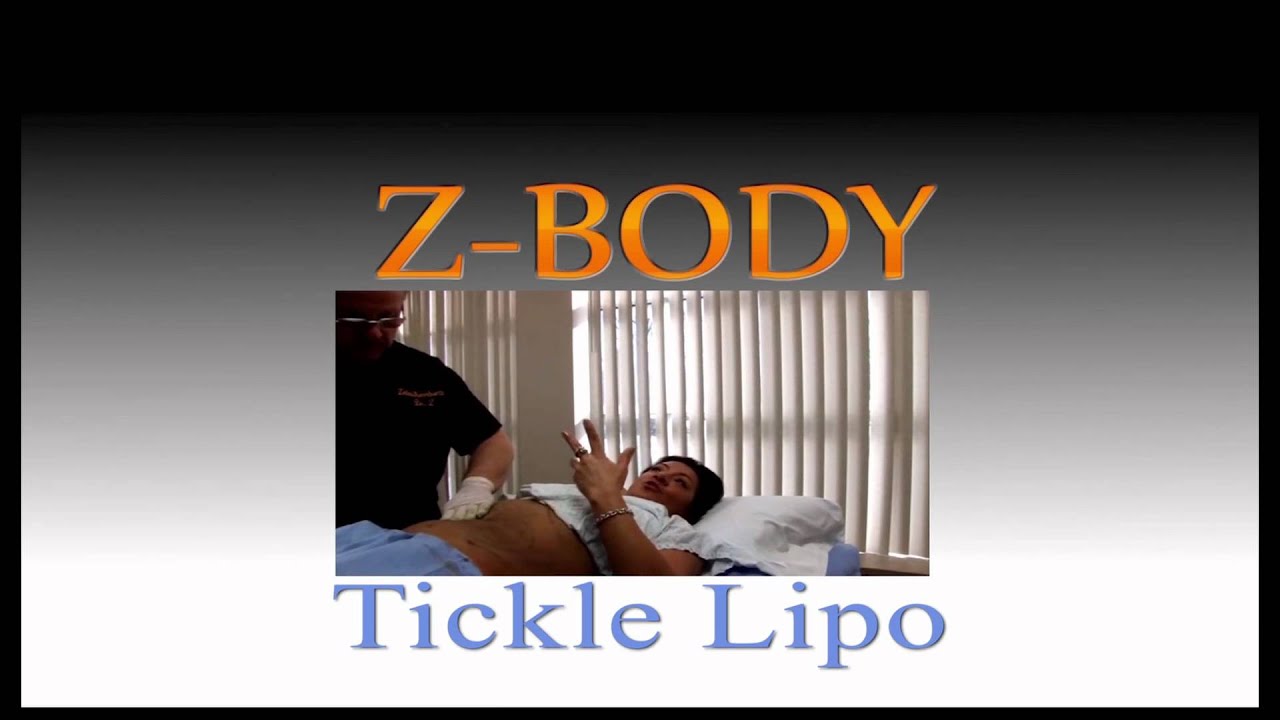 Tickle Liposuction: Watch an Actual Tickle Lipo Procedure Performed