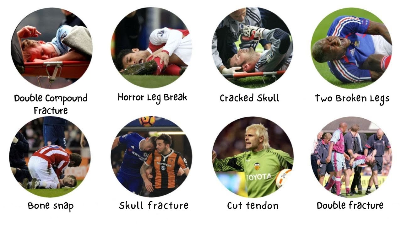 Every Football Injury Too Dark For BBC To Show