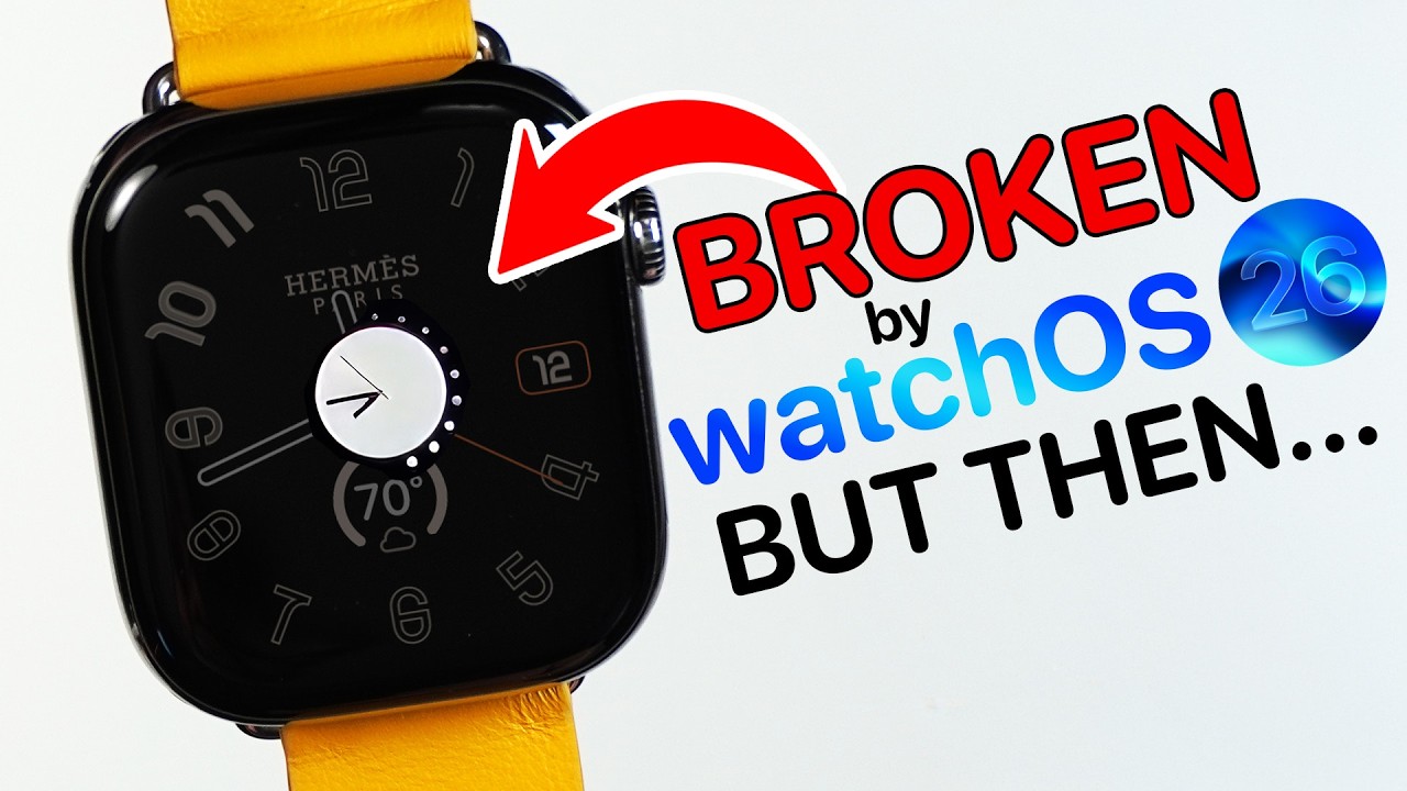 watchOS 26 RUINED My $1300 Apple Watch… Apple’s Response Shocked Me!