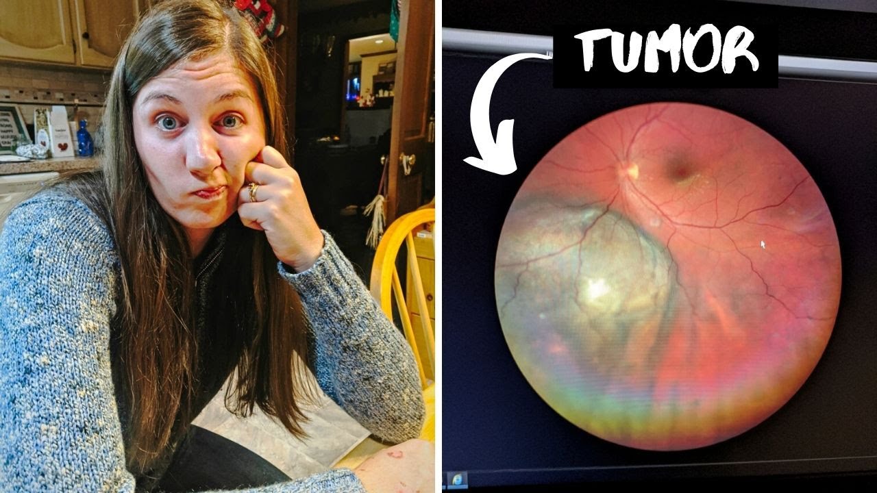 I Have Cancer | My Ocular Melanoma Story Part 1