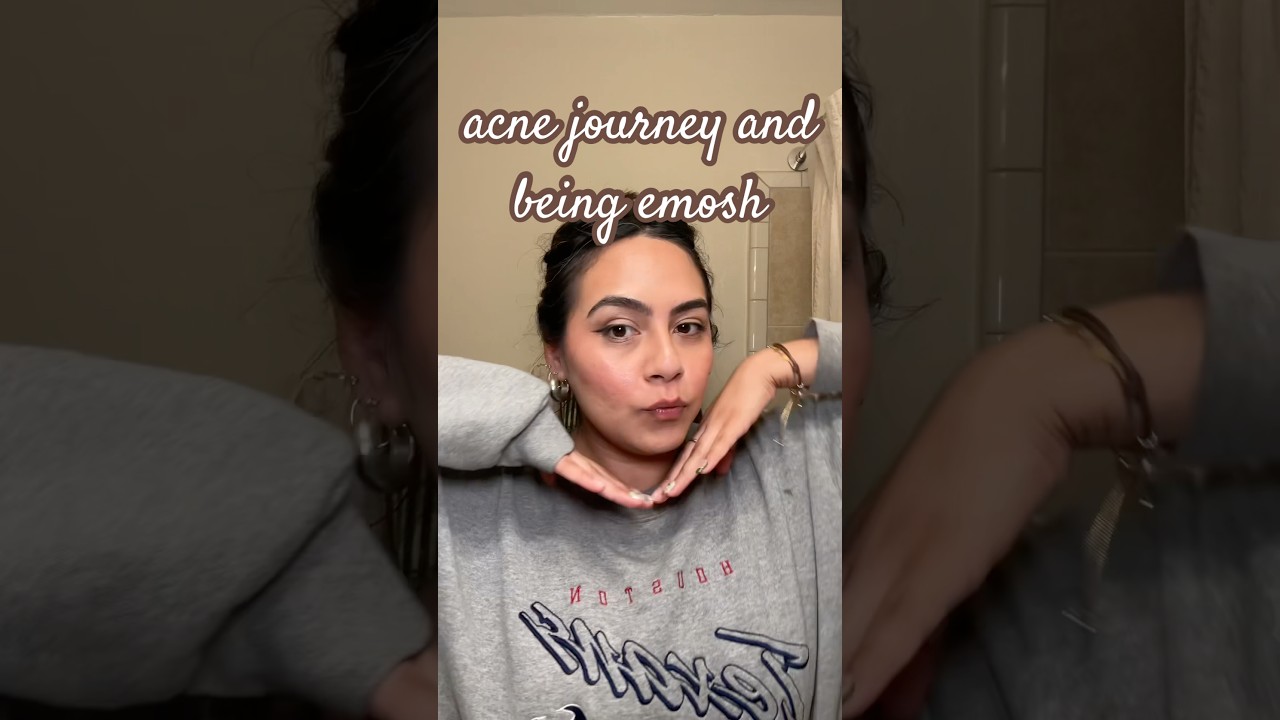 trying medicube again. this ep we talk about my acne and talking about my feelings. #emosh #acne
