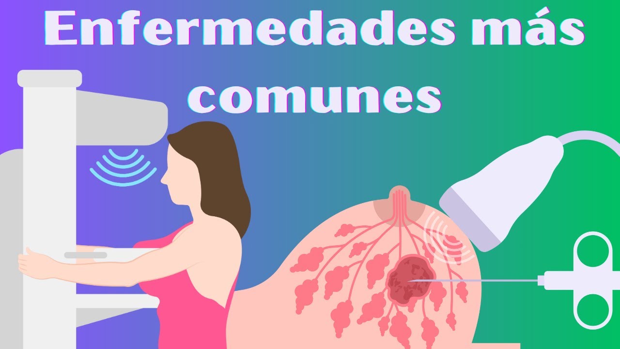 Enfermedades y tumores más comunes en la mama
