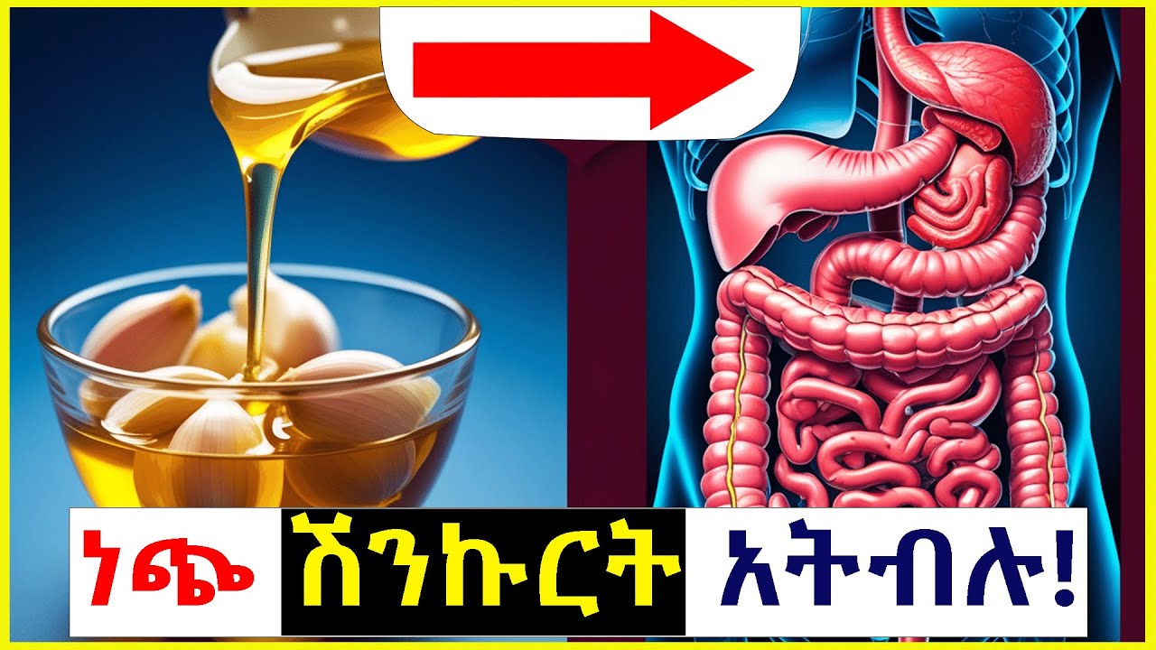 ተአምረኛው ነጭ ሽንኩርት የጤና ጥቅሞች! አደገኛ ጉዳቶች! | Who should avoid taking Garlic 2025
