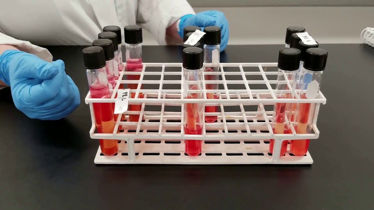Microbiology of Water: Presumptive Test