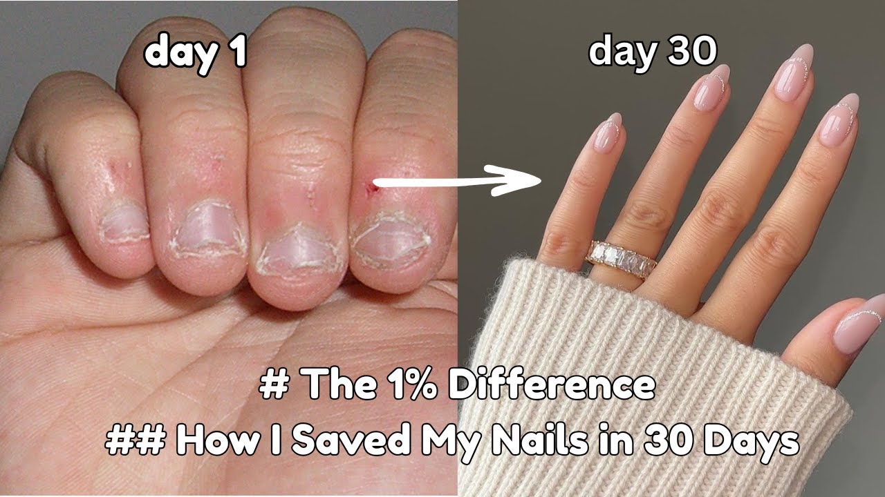 How I Grew My Nails in 30 Days (The Natural Way) 2025-2026✨#NaturalNails #NailGrowthJourney