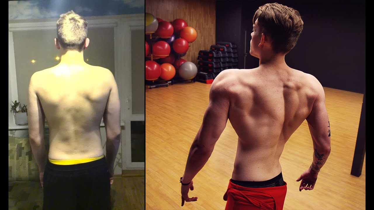 Dovydas Kazlauskas - Disabled 3 years transformation