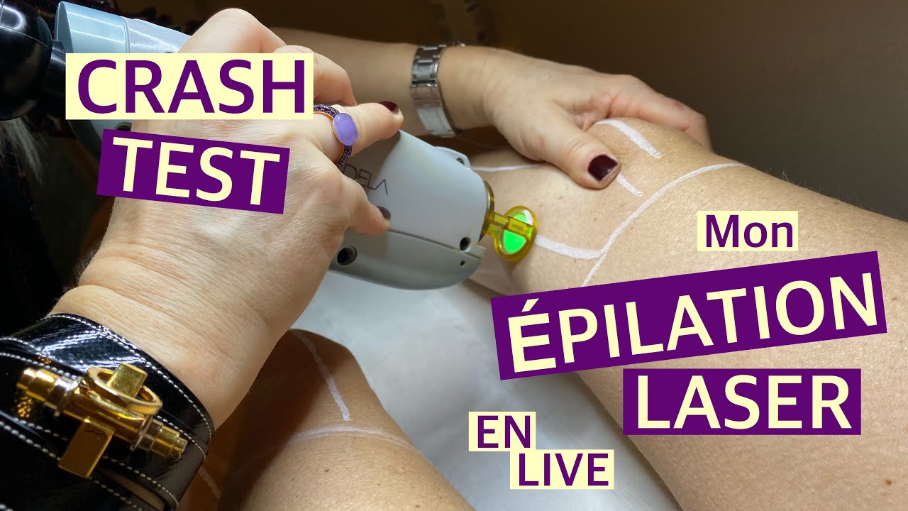 JE TESTE L’ÉPILATION LASER DÉFINITIVE !