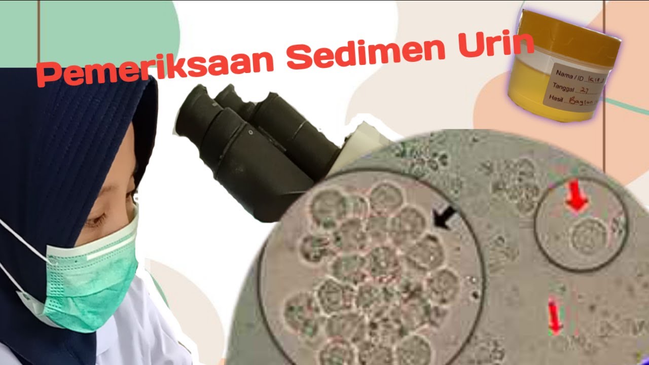 Pemeriksaan Sedimen Urin