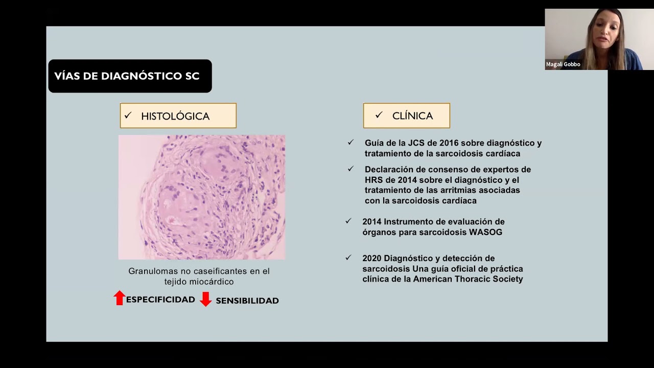 Clase 21 - Sarcoidosis cardíaca