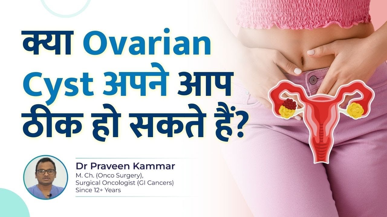 क्या Ovarian Cyst अपने आप ठीक हो सकते हैं? | Can Ovarian Cysts DISAPPEAR?! | Dr Praveen Kammar