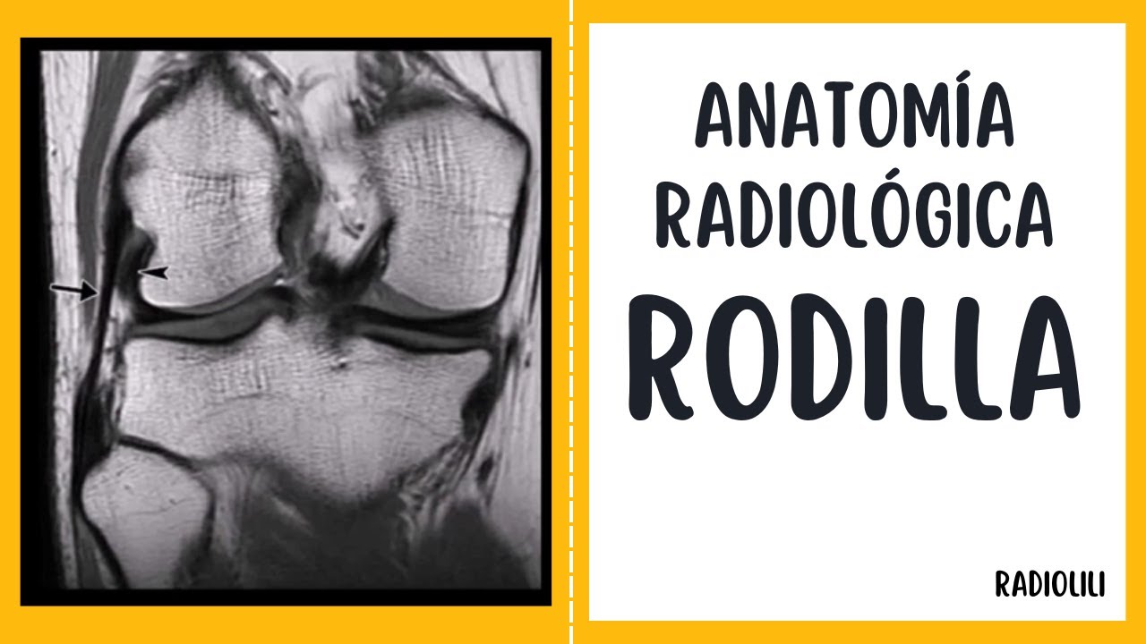 Anatomía Radiológica - Resonancia Magnética: Rodilla.