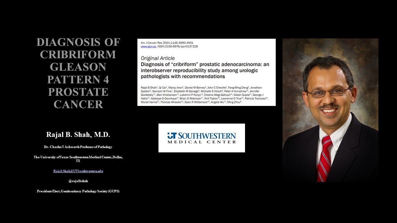 Reproducible Morphological Features For Diagnosis of Cribriform Prostate Adenocarcinoma