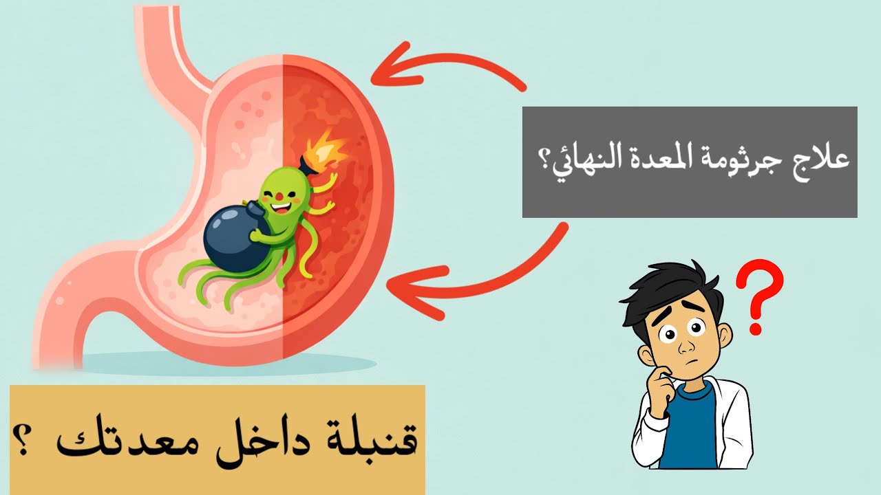 جرثومة المعدة: الأعراض، الأسباب، والحل النهائي للتخلص منها للأبد (دليل علمي شامل)