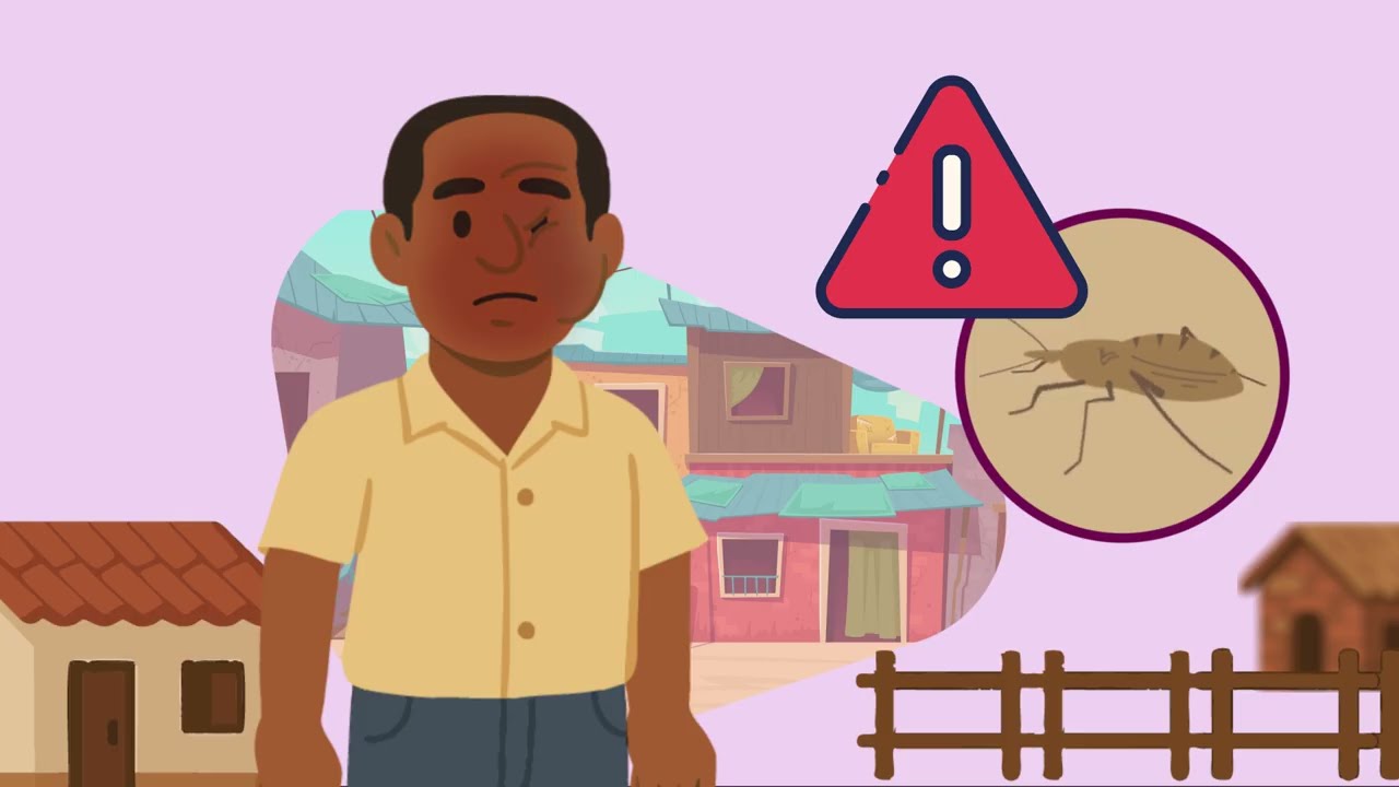 Check for Chagas