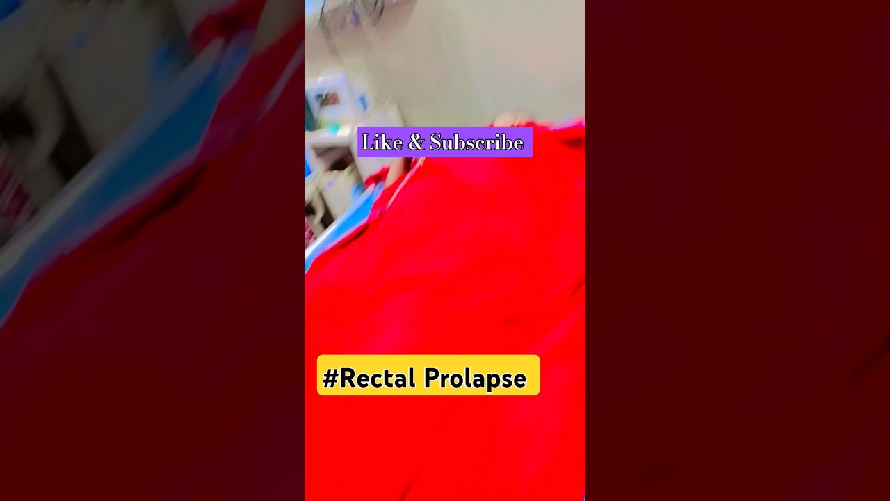 Rectal Prolapse Surgery: What You Need to Know