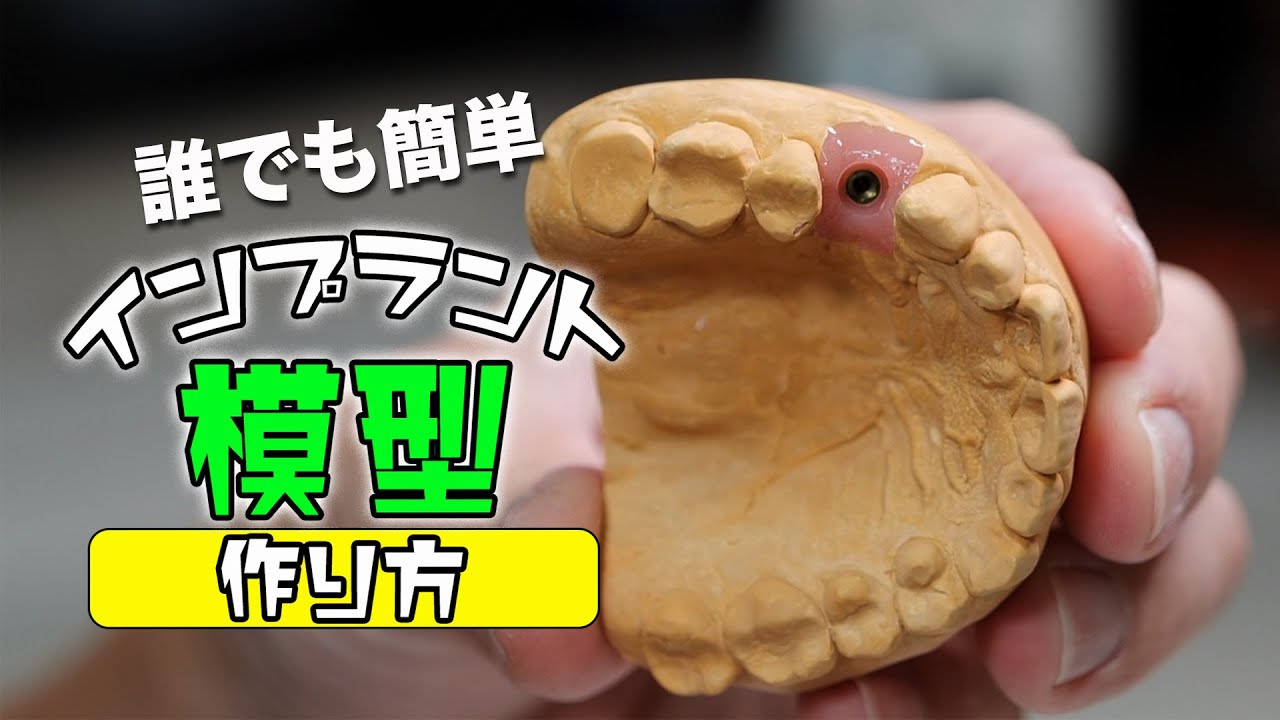 【歯科技工】インプラント模型の作り方！