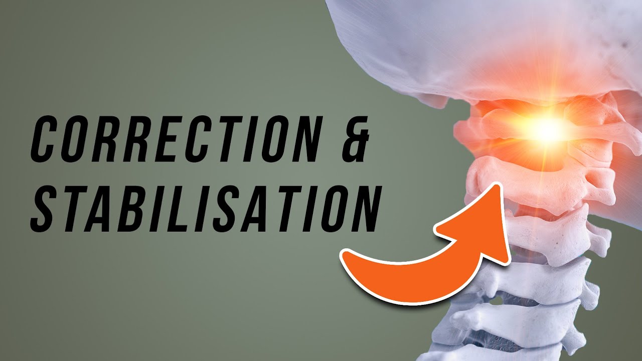 ATLAS Misalignment // Upper Cervical Instability Exercises