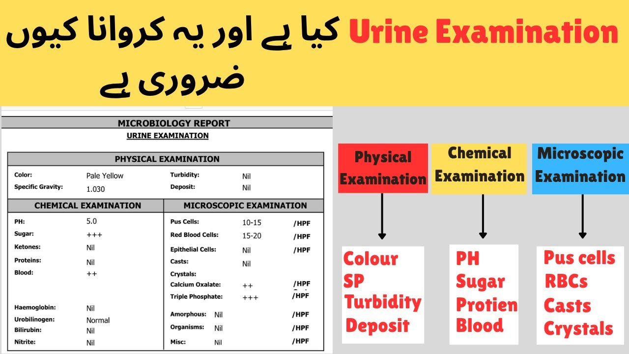 Urine Examination I Urine ki report ko kaise padhen I Urinalysis explained