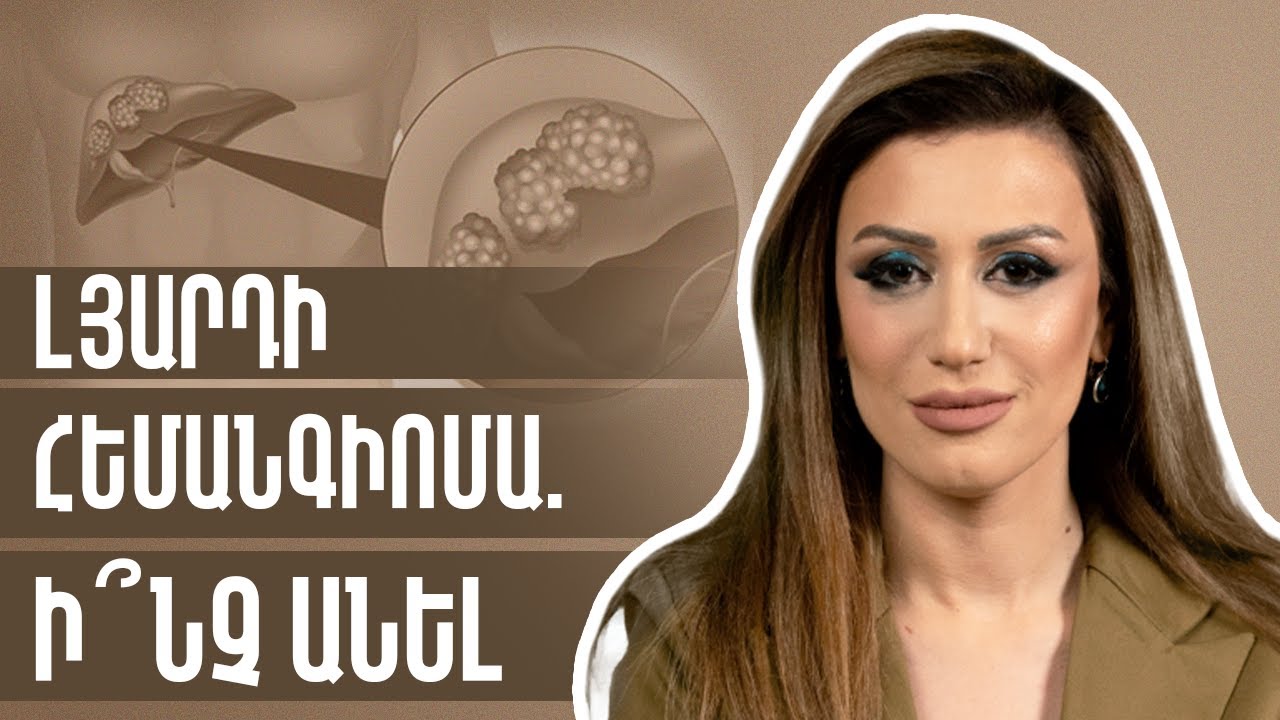 Lյարդի հեմանգիոմա․ Ինչ անել՞ | Gastro Time 45
