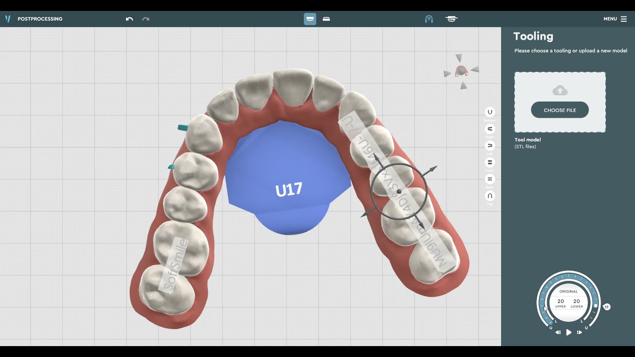 Digital Dental Smile Design Postprocessing Software