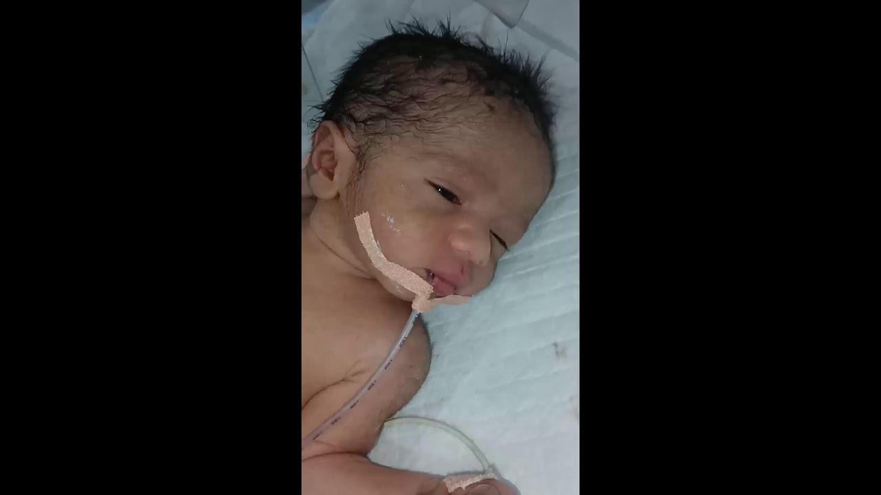 NEWBABAY TUCHNING Live Stream//newborn baby live//babies reaction live//baby nicu live// cutebaby