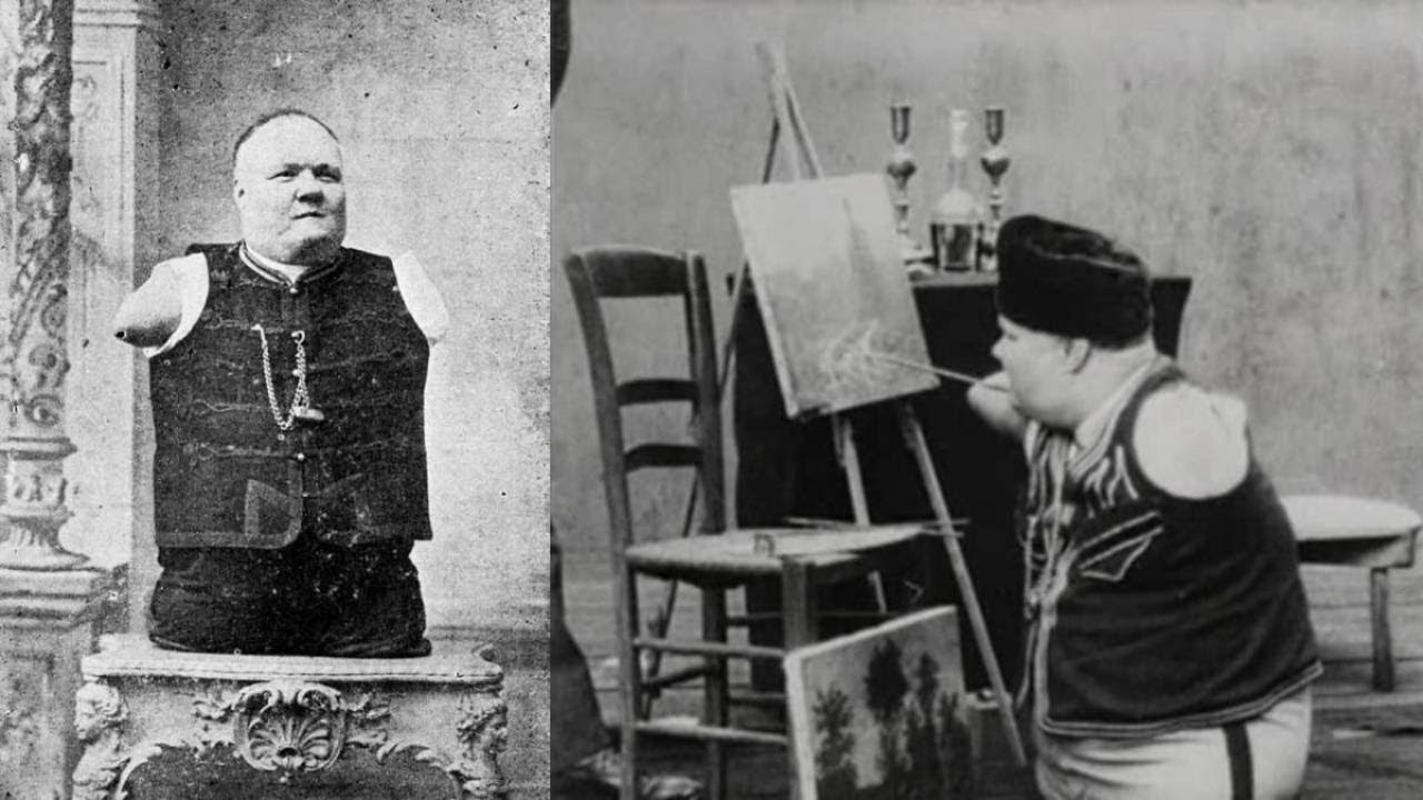 «ЧЕЛОВЕК-ТУЛОВИЩЕ». Как выходец с Урала БЕЗ РУК и НОГ сколотил состояние?
