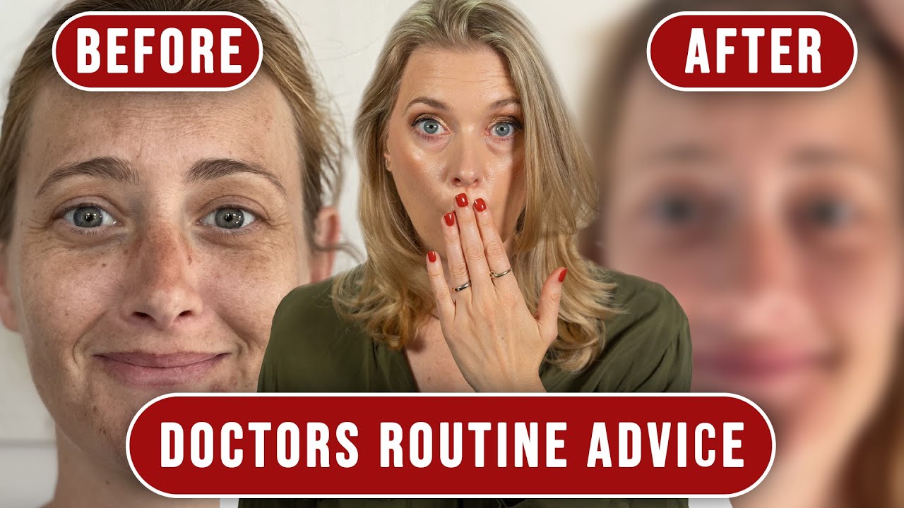 Hyperpigmentation skincare routine for my sister with before and after | Doctor Annes Advice