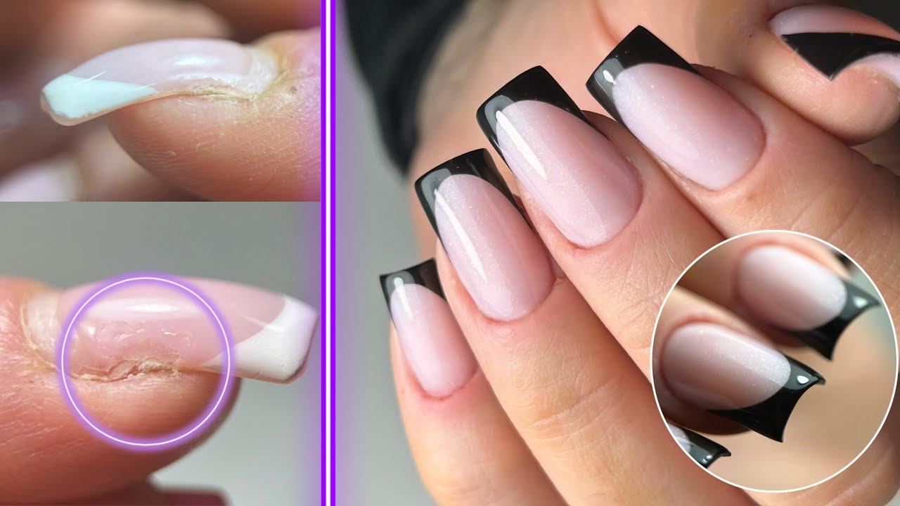 Rattrapage forme & ongle crochu en Dual form- Popits