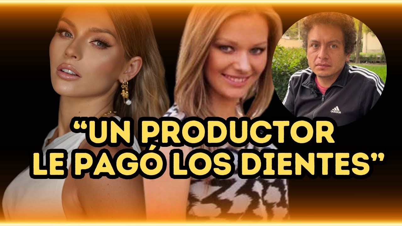 La Transformación de Irina Baeva. ¿Quién le Pagó los Dientes? Su Ex Novio Lo cuenta 2/3