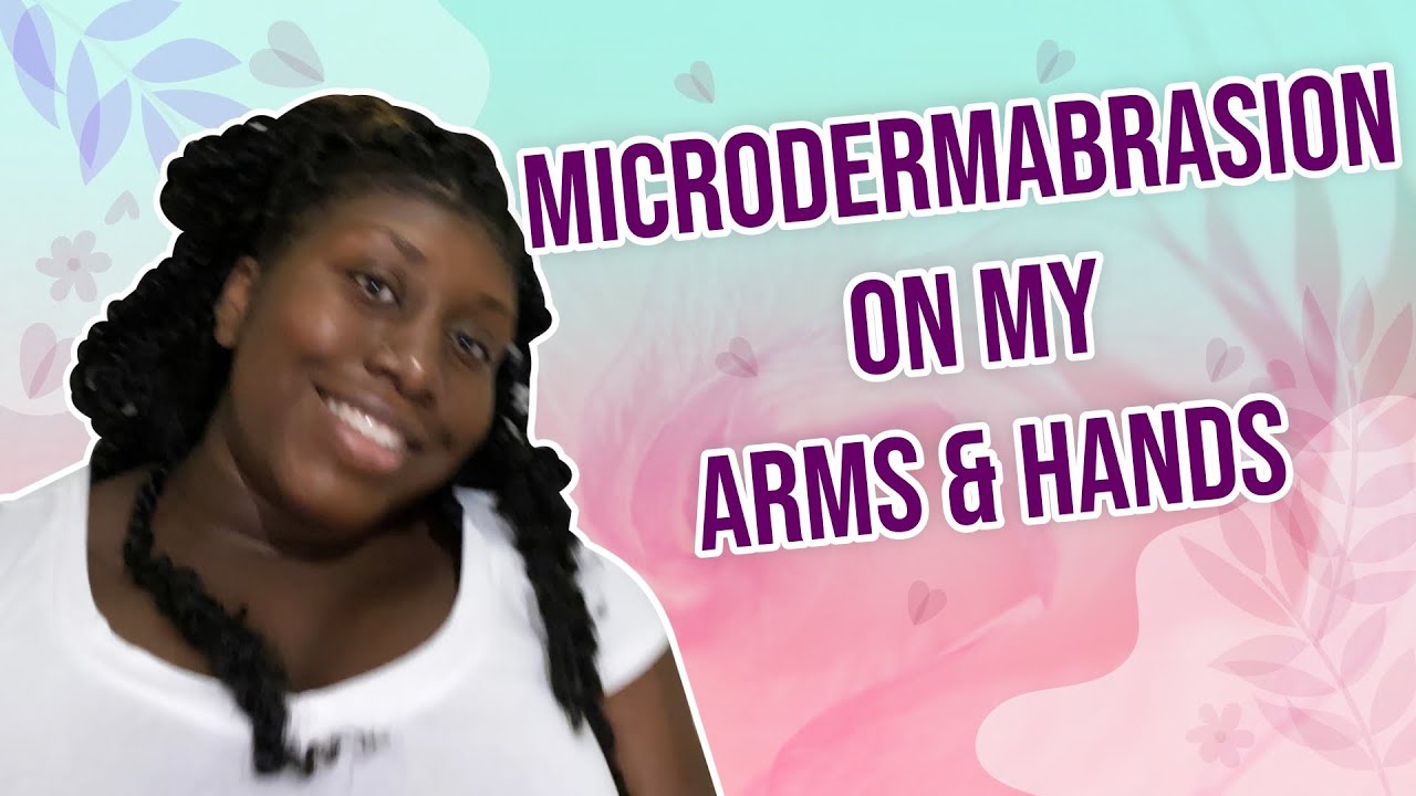 Microdermabrasion on my Arms & Hands