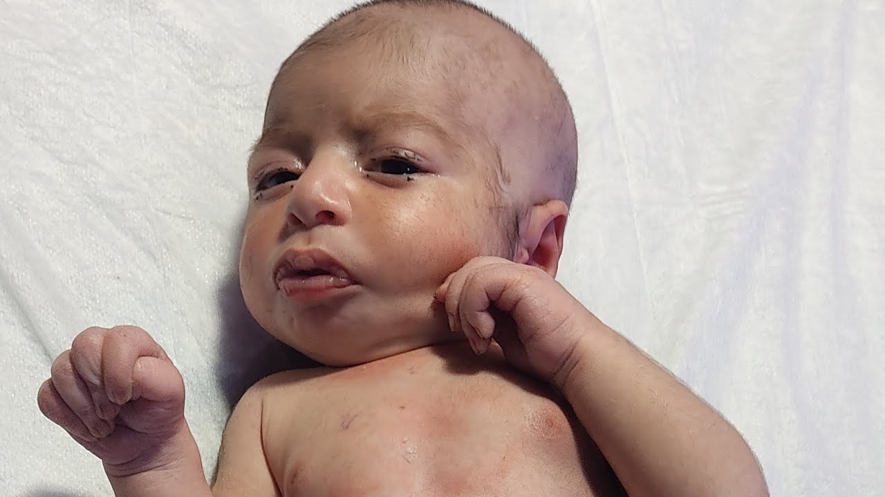 Nebulization and feeding 