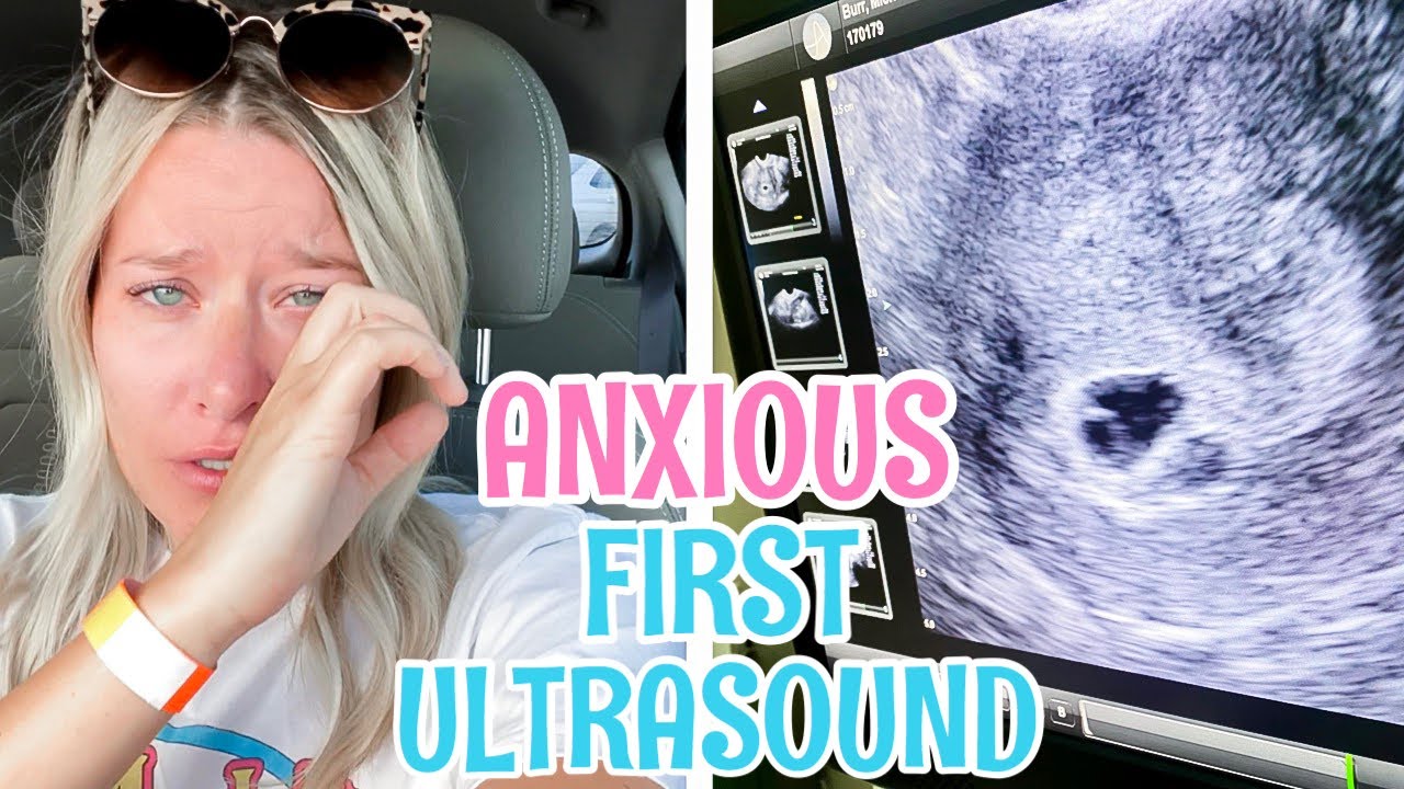 OUR FIRST ULTRASOUND | 5 WEEKS PREGNANT