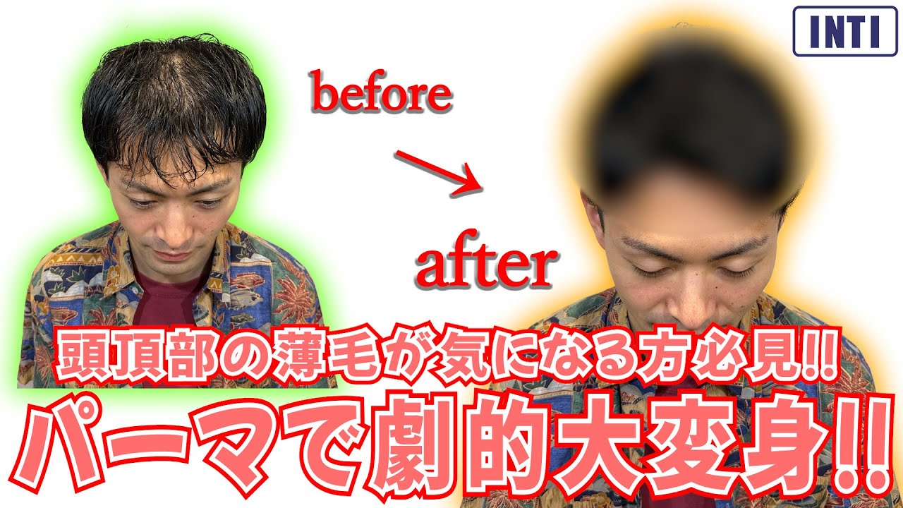 【薄毛】頭頂部の薄毛が気になる方必見！パーマで劇的大変身！！