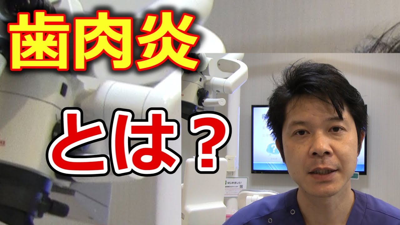 歯肉炎とは、どういったものなのか？【千葉市中央区の歯医者】