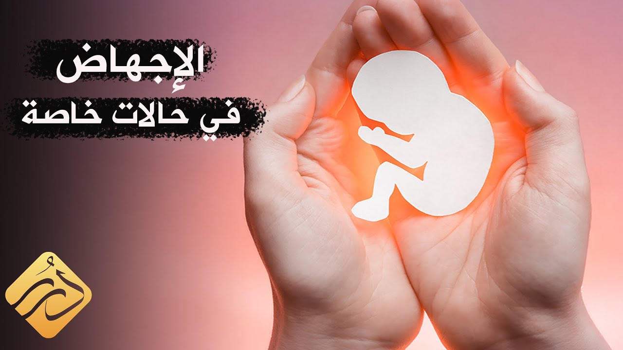 حالات خاصة يجوز فيها الإجهاض .. د. علي القره داغي