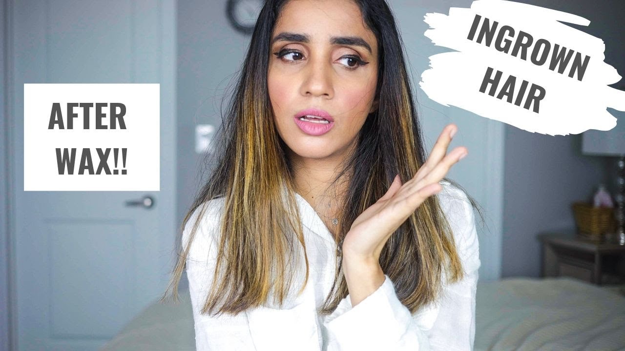How to Really Prevent Ingrown Hair After Waxing