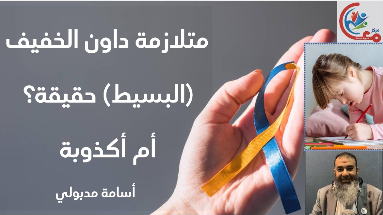 متلازمة داون الخفيف (البسيط) حقيقة أم اكذوبة مع أسامة مدبولى Down syndrome تابع الشرح اسفل الكلام