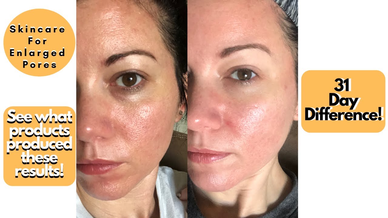 Best Pore Reducing Products | My Skincare Routine