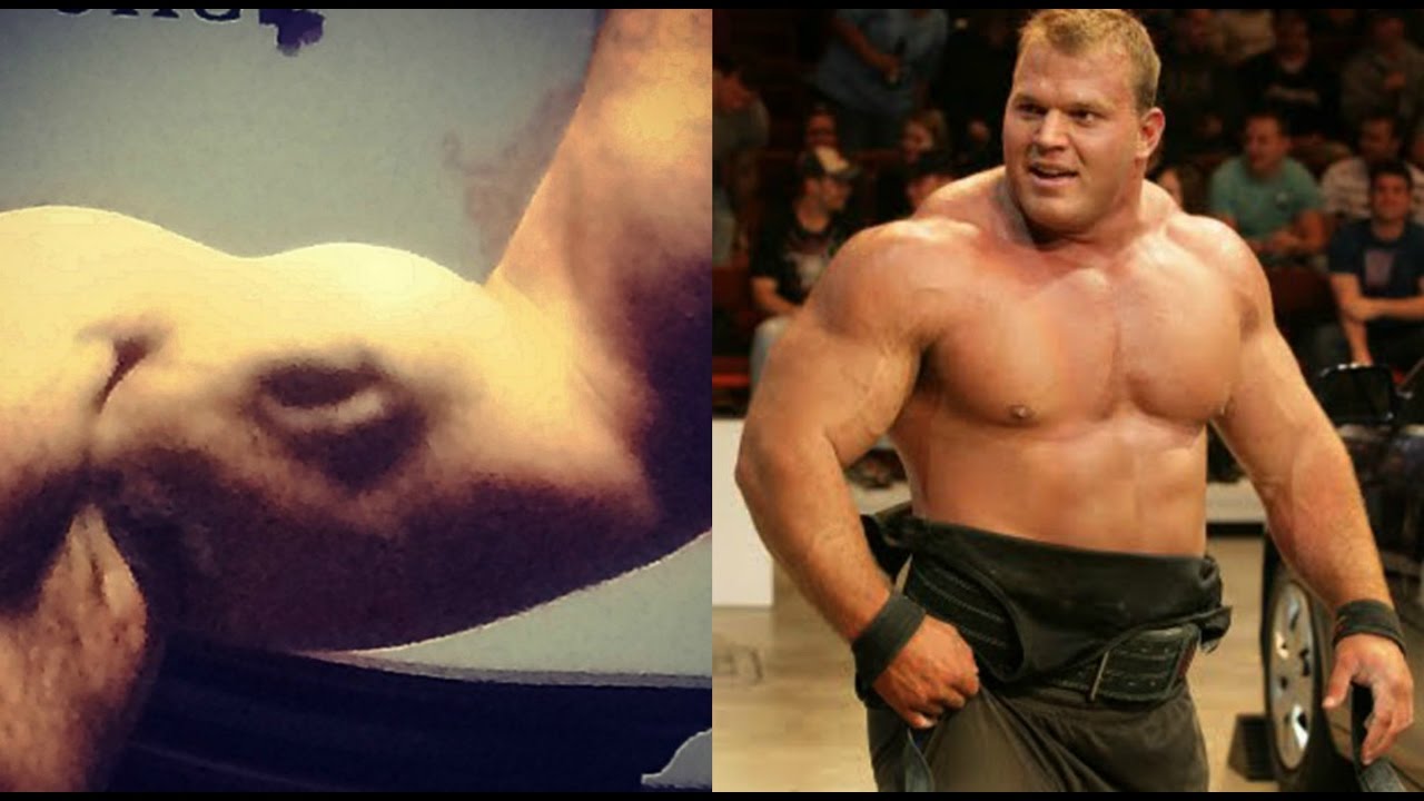 What happened to Derek Poundstone?
