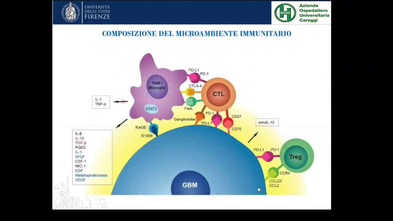 Microambiente immunitario nel glioma cerebrale