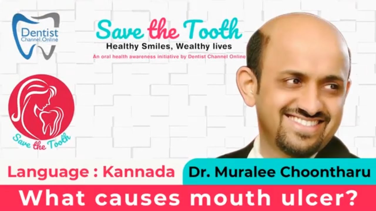 What causes mouth ulcer? - Kannada