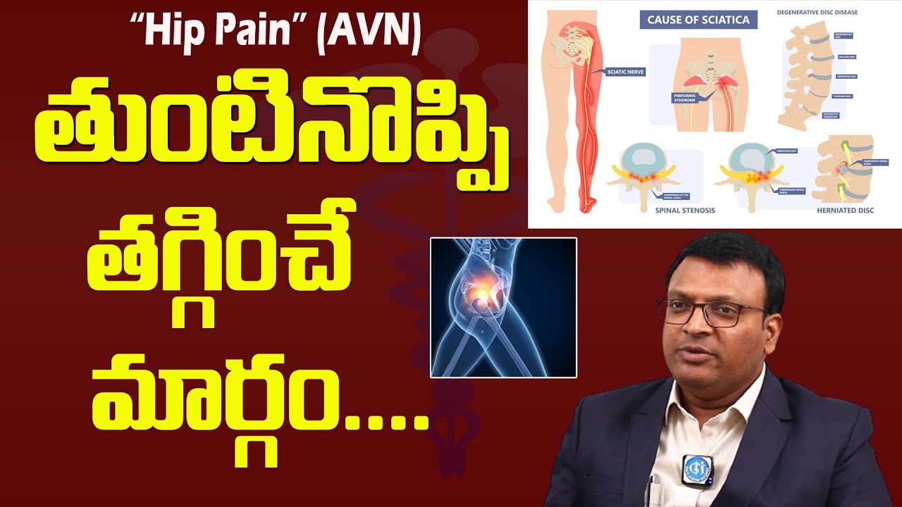 How can get rid of hip pain? తుంటి నొప్పి నుండి ఎలా బయటపడాలి ? | DR. Sathish Reddy | iDream Health