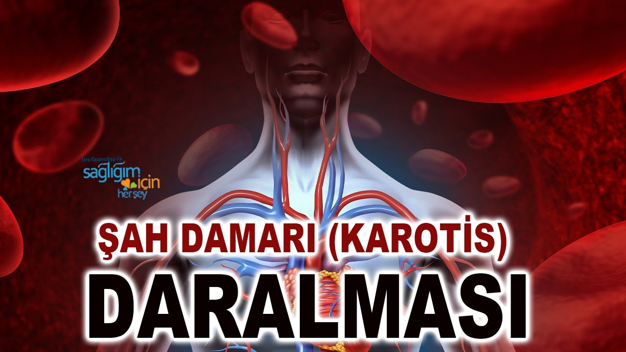 Şah Damarı Daralmasının Belirtileri ve Tedavisi