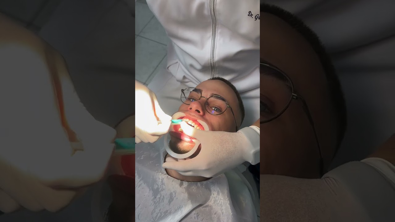 Eu resolvi fazer um CLAREAMENTO DENTAL!!! #shorts